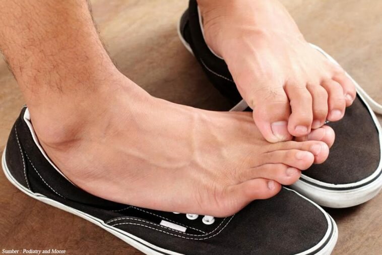 Tips Hilangkan Bau Kaki Secara Alami